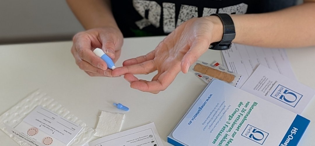 Durchführung des Tests